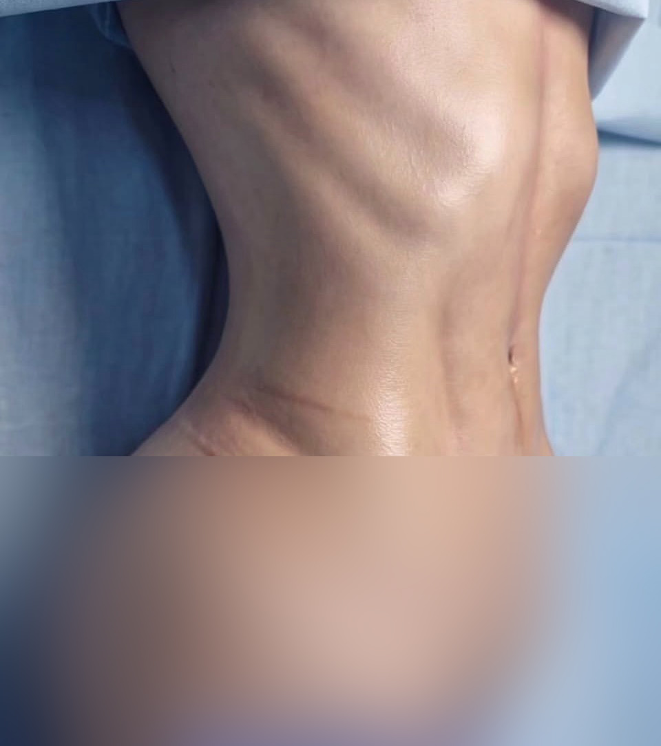 نمونه نتیجه بعد از جراحی ۵