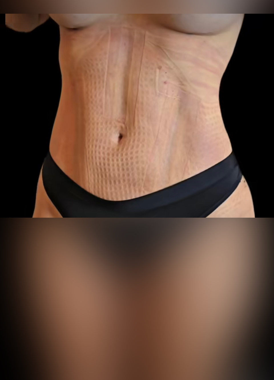 نمونه نتیجه بعد از جراحی ۶