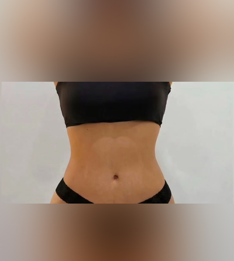 نمونه نتیجه بعد از جراحی ۸