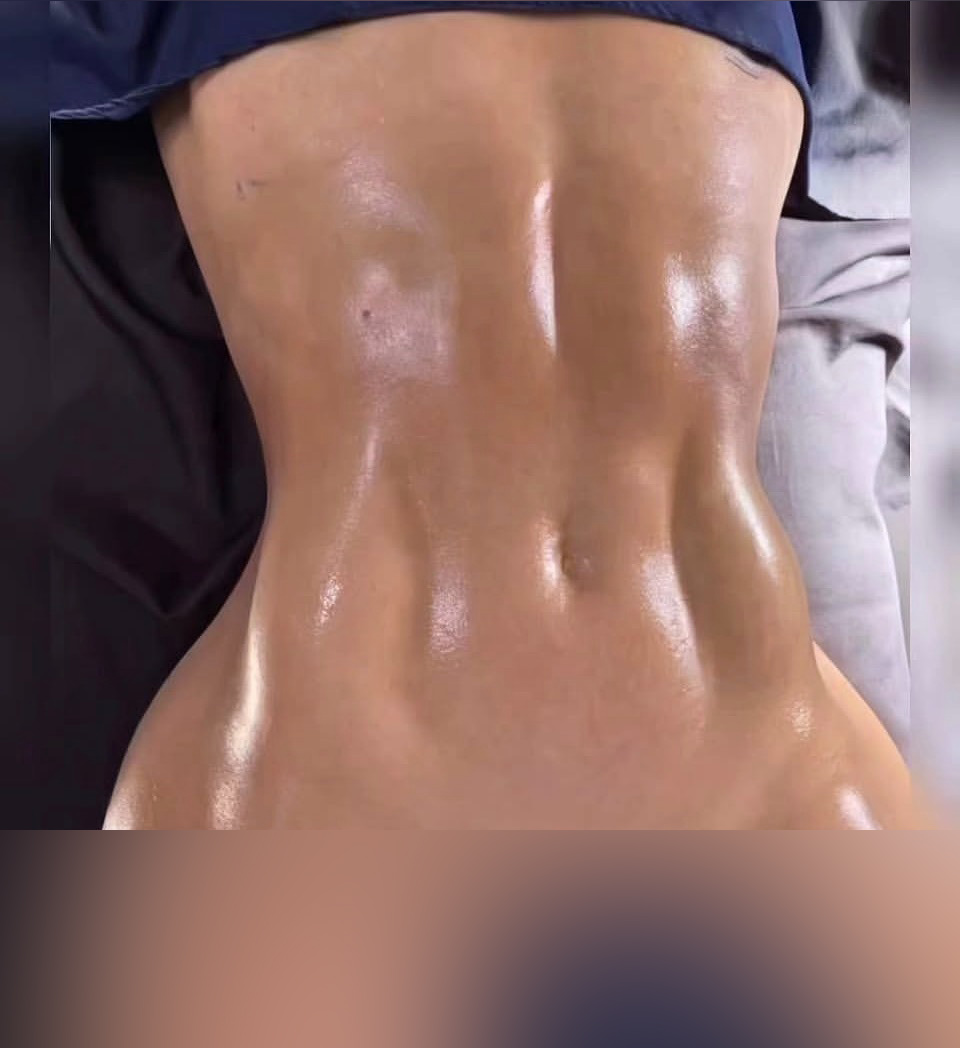 نمونه نتیجه بعد از جراحی ۹