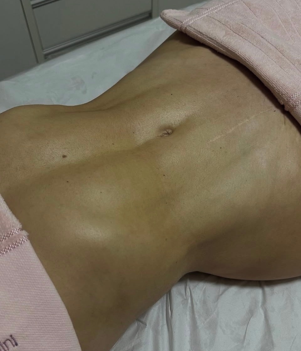 نمونه نتیجه بعد از جراحی ۱۰