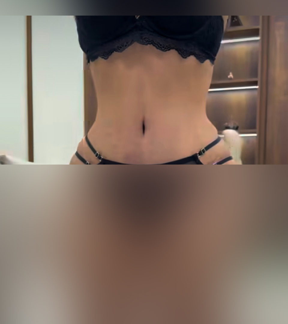 نمونه نتیجه بعد از جراحی ۴